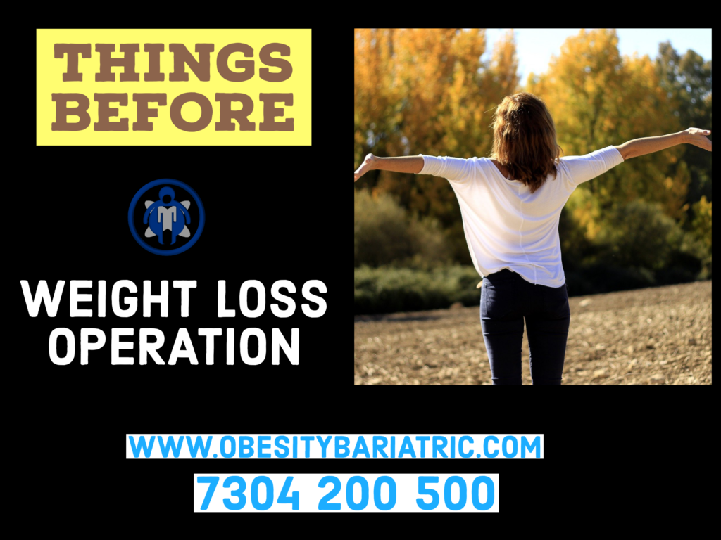 weight loss operation