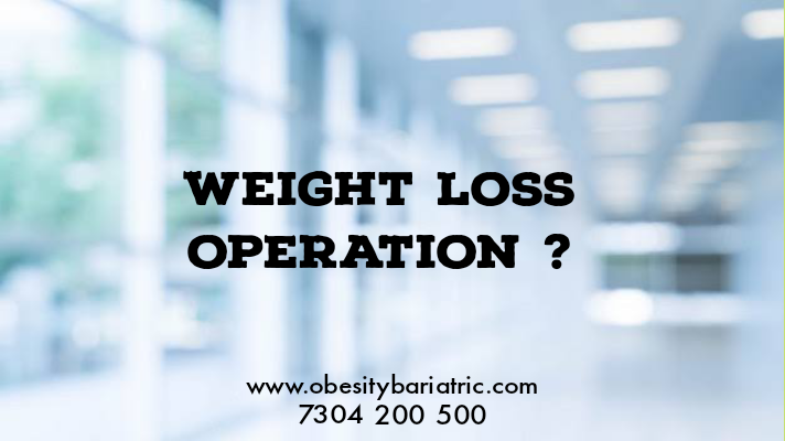 weight loss operation